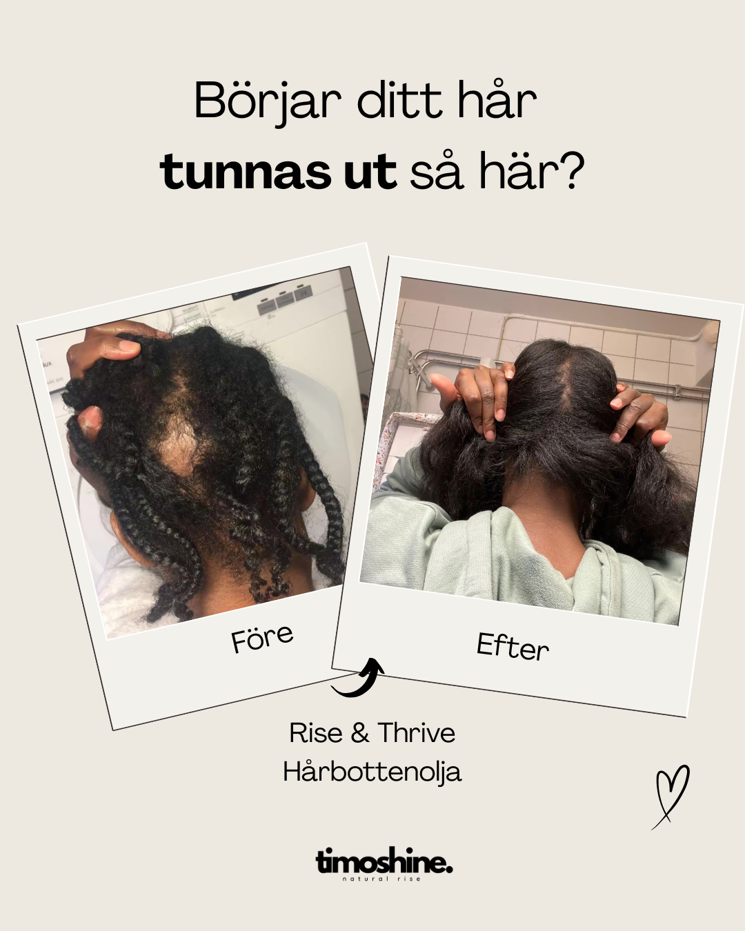 Rise & Thrive - Hårbottenolja